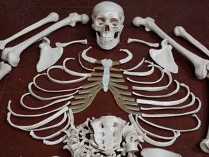 Bone set