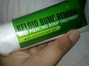 Keloid & Piercing Bump Removal Scar Gel