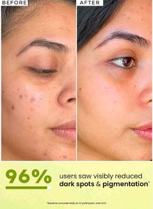 Hyphen Double Short Radiance Lift Serum