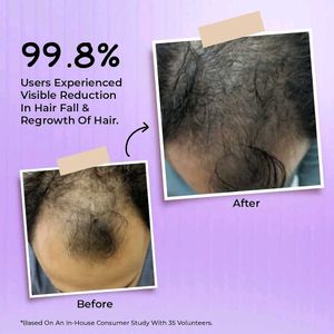 Dr. Bakshi's BAKSON'S HOMOEOPATHY Hair Reviver-100