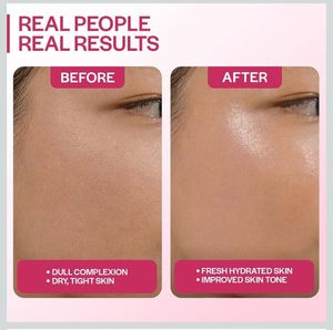 SUROSKIE Rose Elixir Face Toner