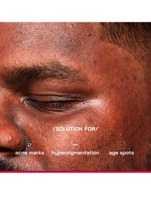 PHD 2% Alpha Arbutin Depigmentation Serum