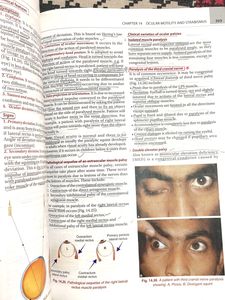 Khurana Ophthalmology