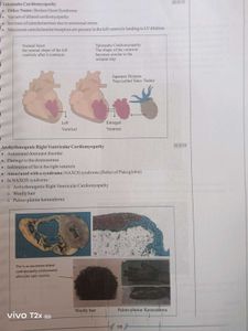 Structured Notes Pathology - Dr. Preeti Sharma