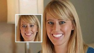 20 Minute Dental White Teeth Whitening Kit