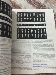 Wheeler's Dental Anatomy, Physiology and Occlusion