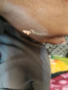 Foundation