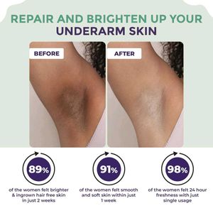 Sanfe Underarm Lightening Roll On