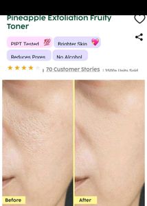 PIXI Pineapple Exfoliation Fruity Toner
