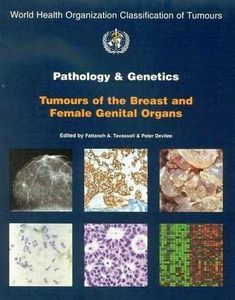 Pathology & Genetics: Tumours of the Breast