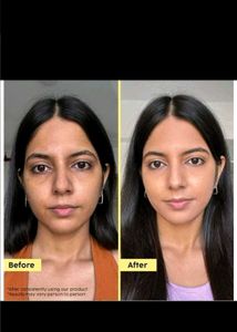 MRP-500 Plix Pineapple Advanced Depigmentation Dew