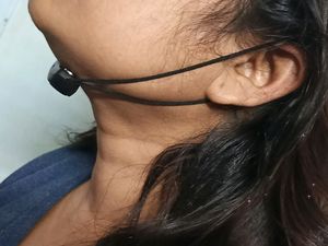 Anti Snoring Device