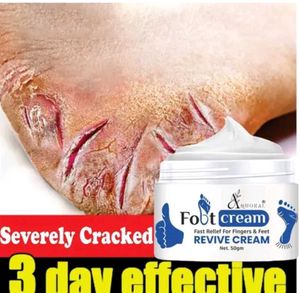 Foot Crack Heal Cream