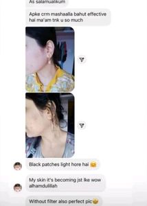 Skin Whitening Cream