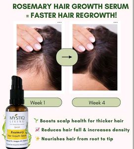 Rosemary Hair Growth Serum for Thicker Hai
