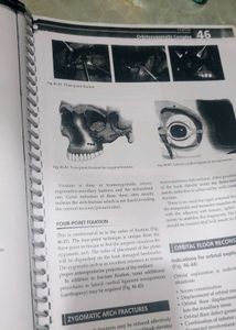 Odontogenic Tumours Textbook Chapter