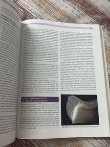 Phillips' Science of Dental Materials