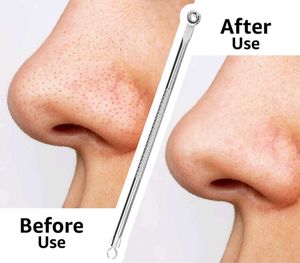 Stainless Steel Blackhead Remover Tool