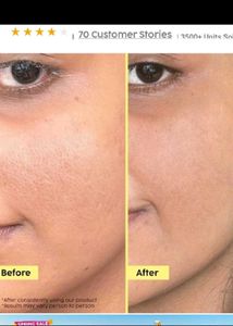 Plix Pineapple Exfoliation Fruity Toner