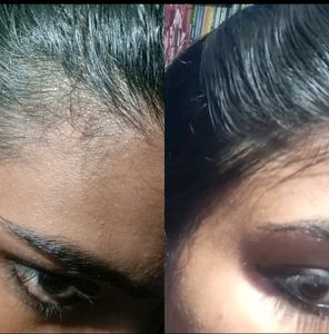 Homemade Secret Herbal Hairgrowth Oil