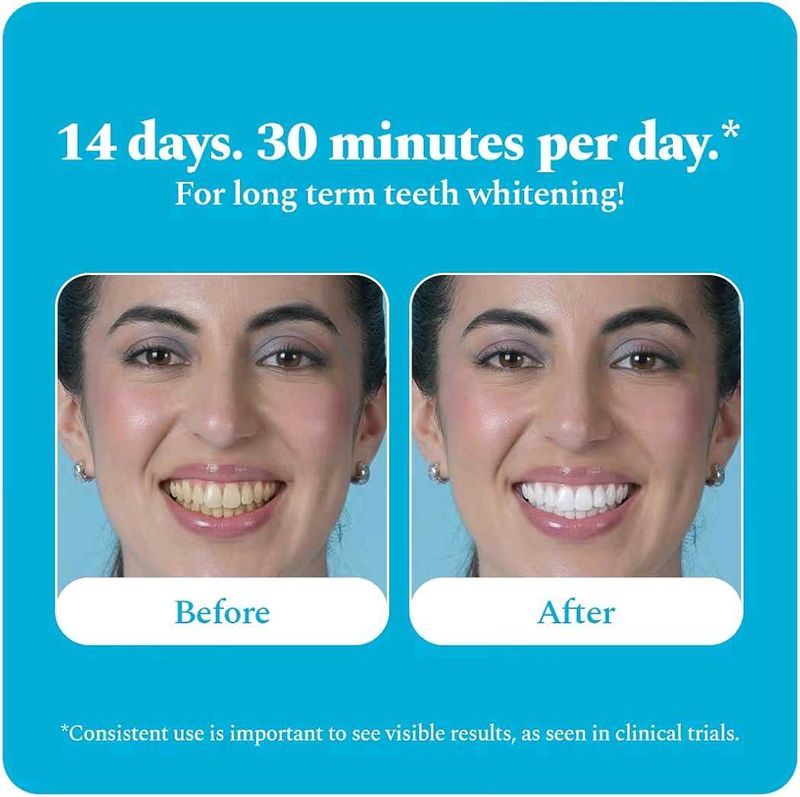 Perfora Teeth Whitening Strips - Classic Mint