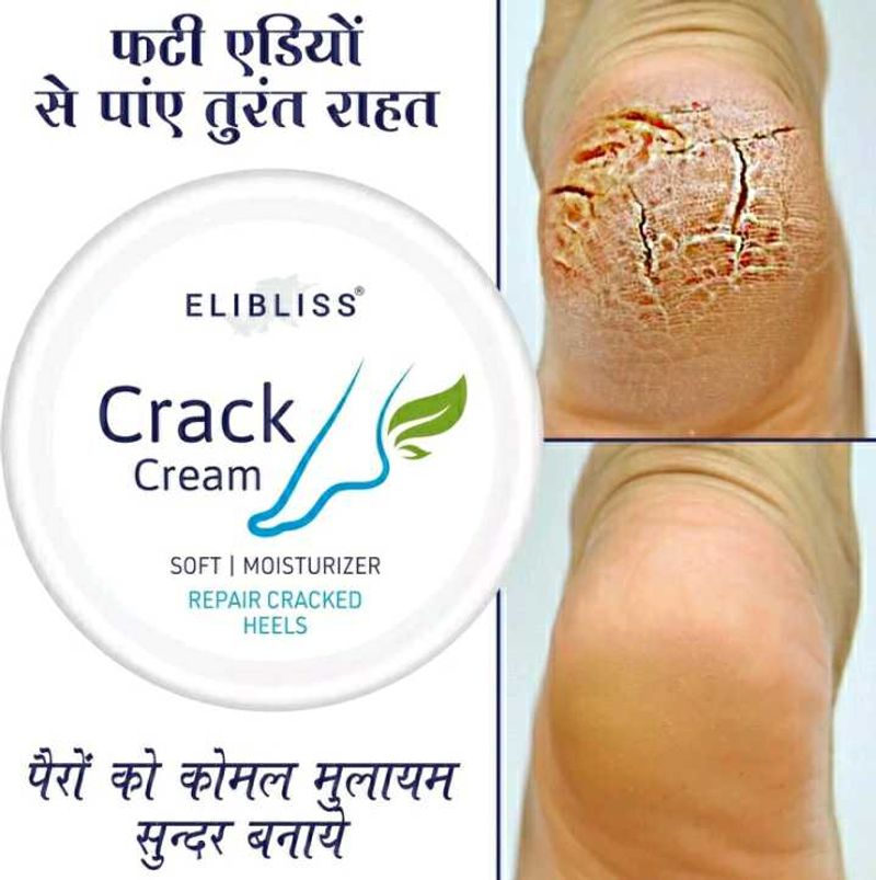 Crack Heel Repair Cream